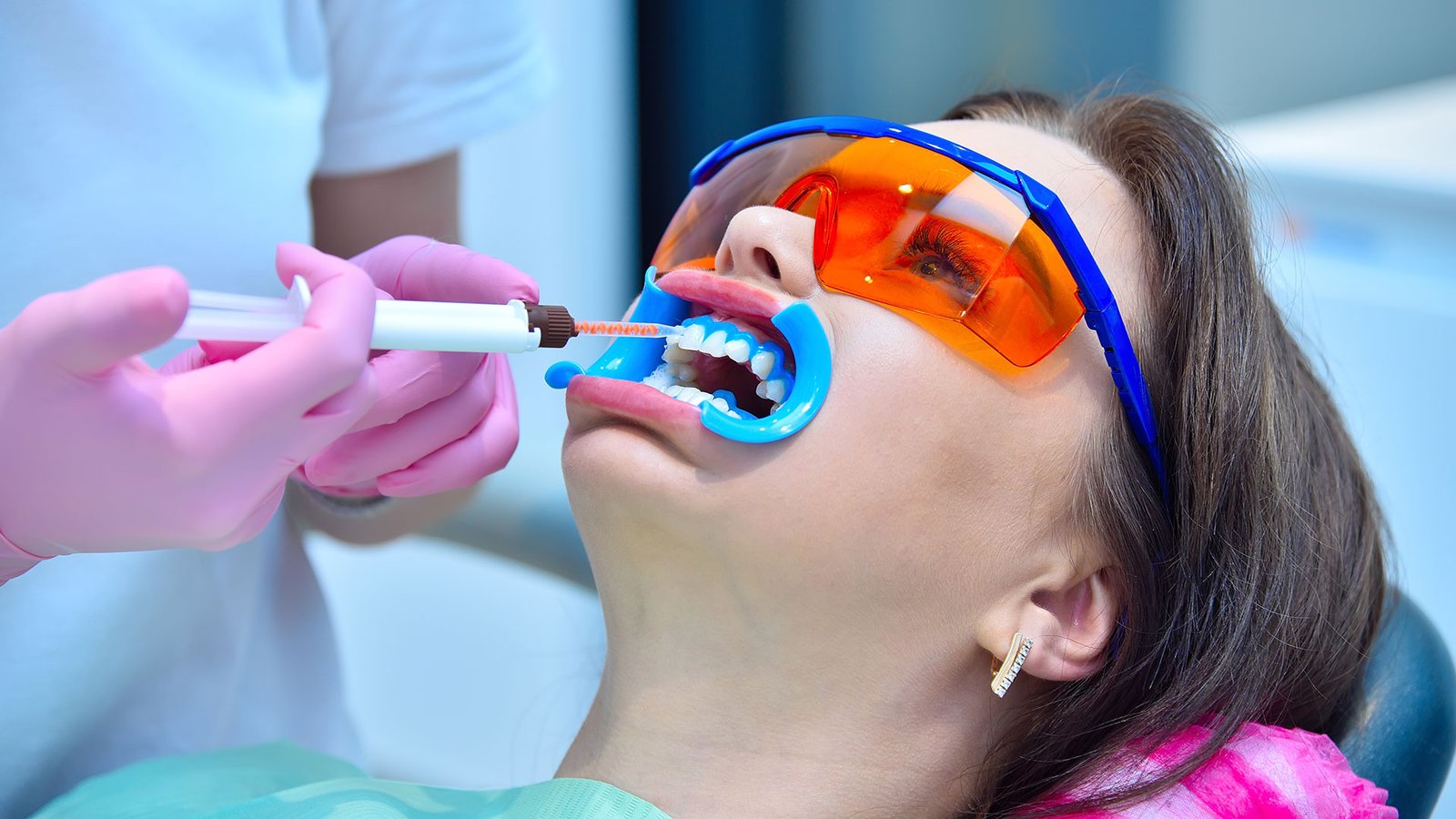 blanqueamiento dental