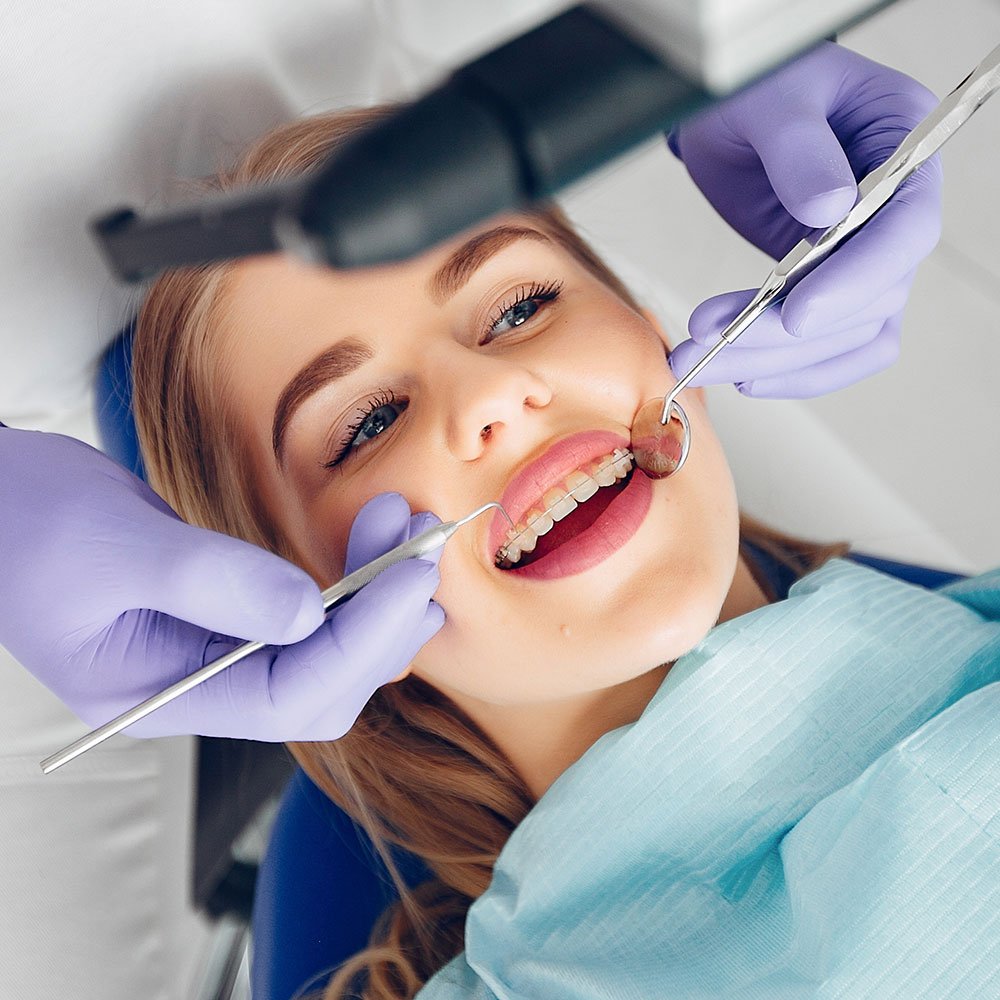 mujer rubia con brackets estéticos