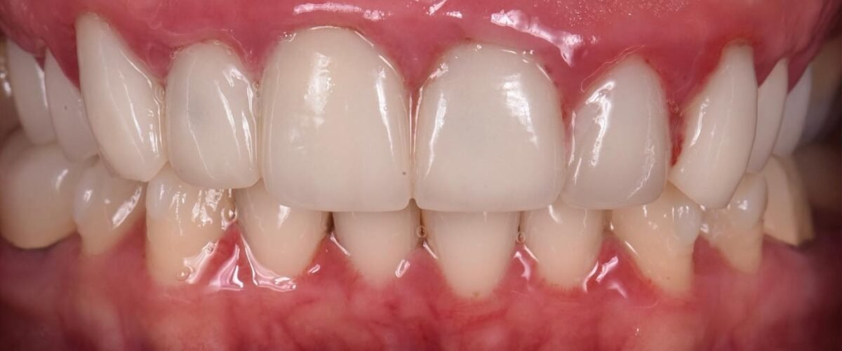 caso dental antes